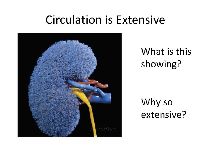 Circulation is Extensive What is this showing? Why so extensive? 