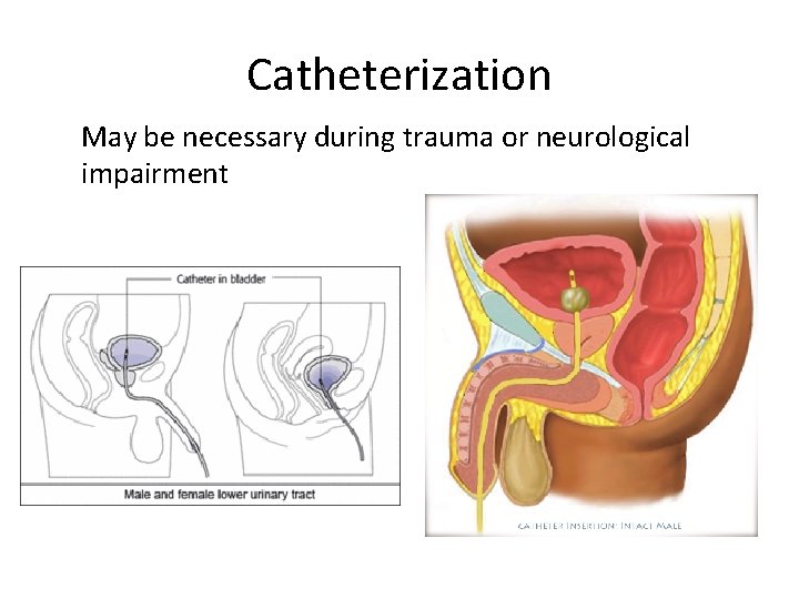 Catheterization May be necessary during trauma or neurological impairment 