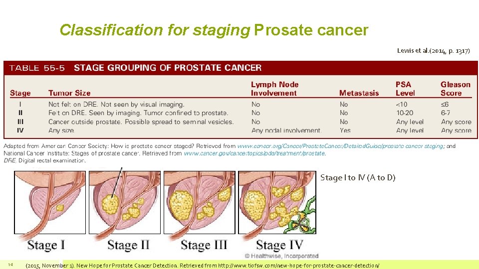 prostate enlargement stages Hogyan kell fájni a prosztatitis