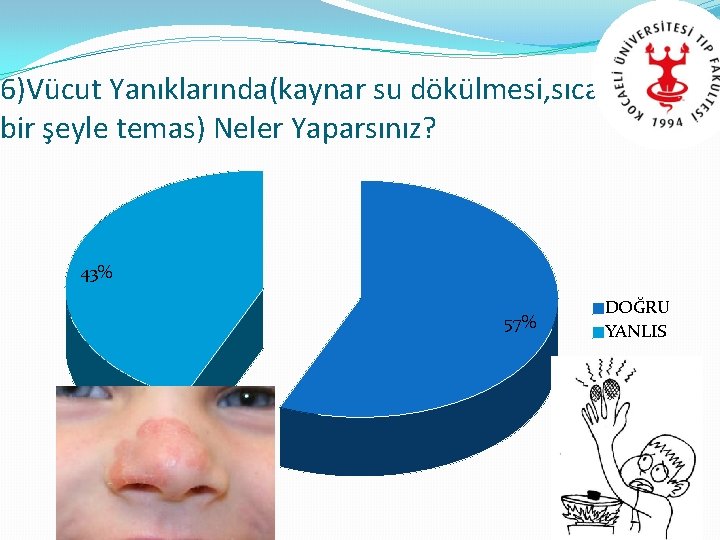 6)Vücut Yanıklarında(kaynar su dökülmesi, sıcak bir şeyle temas) Neler Yaparsınız? 43% 57% DOĞRU YANLIS