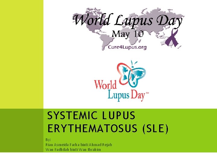 SYSTEMIC LUPUS ERYTHEMATOSUS (SLE) By: Rian Asmeida Farha binti Ahmad Rejab Wan Fadhilah binti