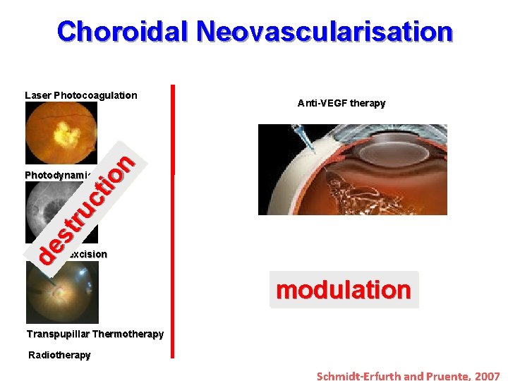 Choroidal Neovascularisation Anti-VEGF therapy de st ru ct io n Laser Photocoagulation Photodynamic Therapy