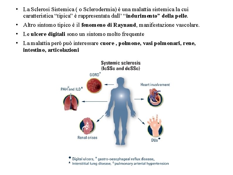 • La Sclerosi Sistemica ( o Sclerodermia) è una malattia sistemica la cui • La Sclerosi Sistemica ( o Sclerodermia) è una malattia sistemica la cui