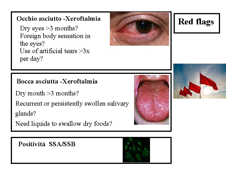 Occhio asciutto -Xeroftalmia Dry eyes >3 months? Foreign body sensation in the eyes? Use Occhio asciutto -Xeroftalmia Dry eyes >3 months? Foreign body sensation in the eyes? Use