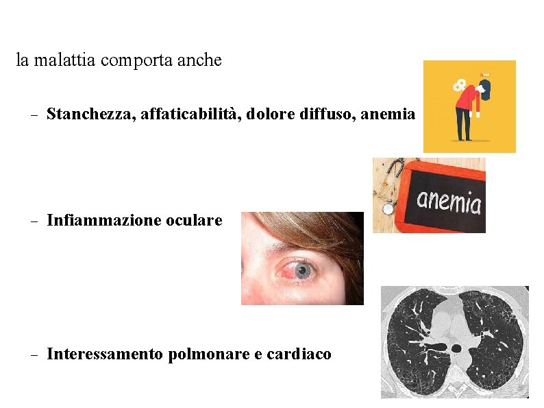 la malattia comporta anche Stanchezza, affaticabilità, dolore diffuso, anemia Infiammazione oculare Interessamento polmonare la malattia comporta anche Stanchezza, affaticabilità, dolore diffuso, anemia Infiammazione oculare Interessamento polmonare
