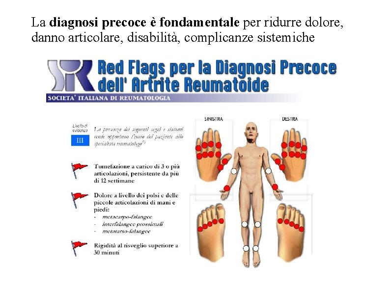 La diagnosi precoce è fondamentale per ridurre dolore, danno articolare, disabilità, complicanze sistemiche La diagnosi precoce è fondamentale per ridurre dolore, danno articolare, disabilità, complicanze sistemiche