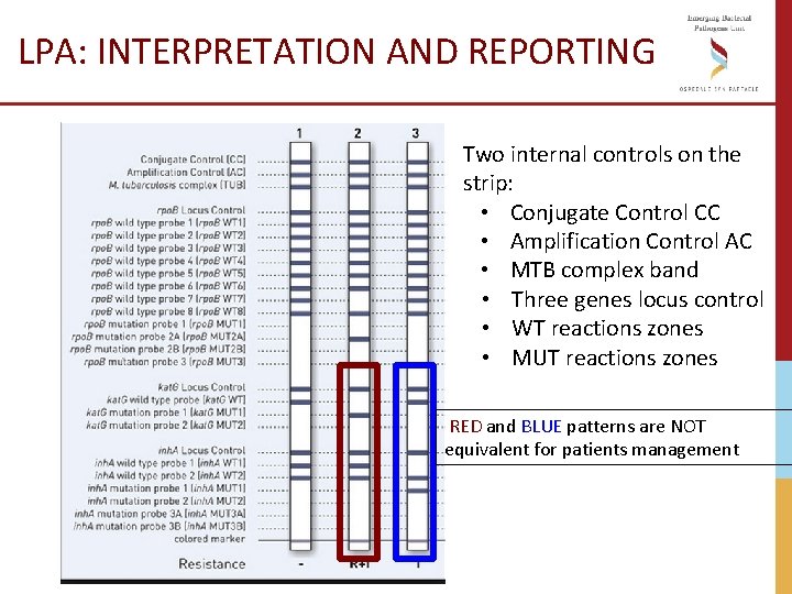 LPA: INTERPRETATION AND REPORTING Two internal controls on the strip: • Conjugate Control CC LPA: INTERPRETATION AND REPORTING Two internal controls on the strip: • Conjugate Control CC