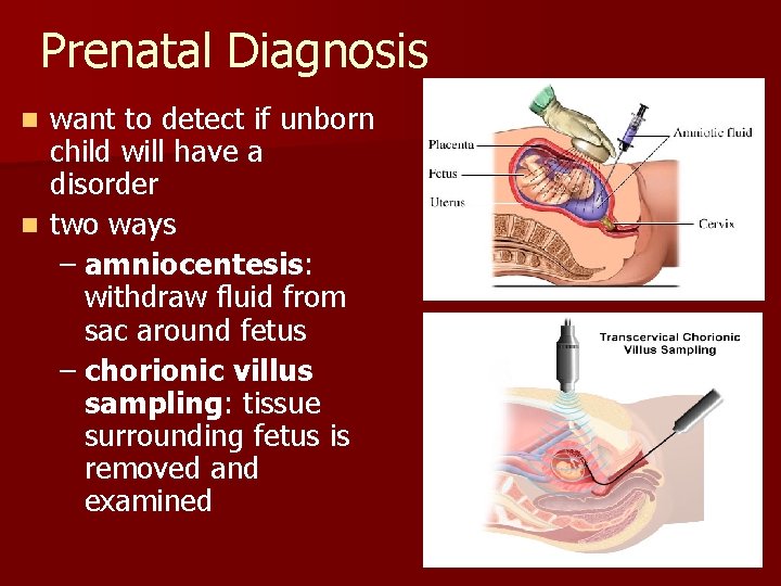 Prenatal Diagnosis want to detect if unborn child will have a disorder n two