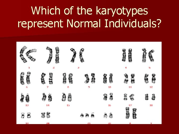 Which of the karyotypes represent Normal Individuals? 