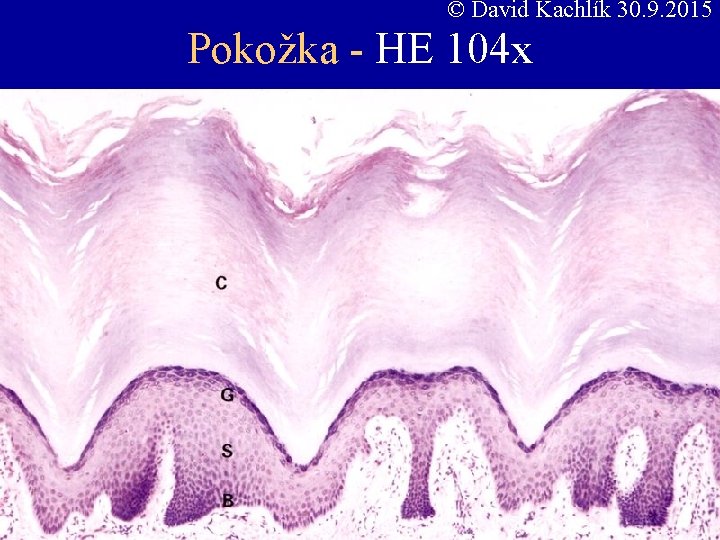 © David Kachlík 30. 9. 2015 Pokožka - HE 104 x 