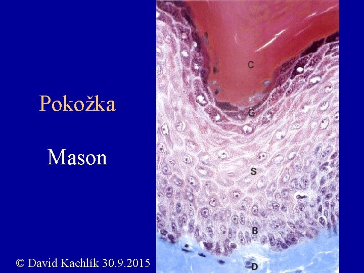Pokožka Mason © David Kachlík 30. 9. 2015 