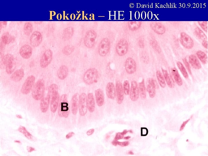© David Kachlík 30. 9. 2015 Pokožka – HE 1000 x 