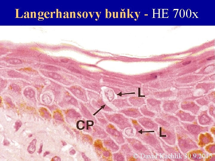 Langerhansovy buňky - HE 700 x © David Kachlík 30. 9. 2015 