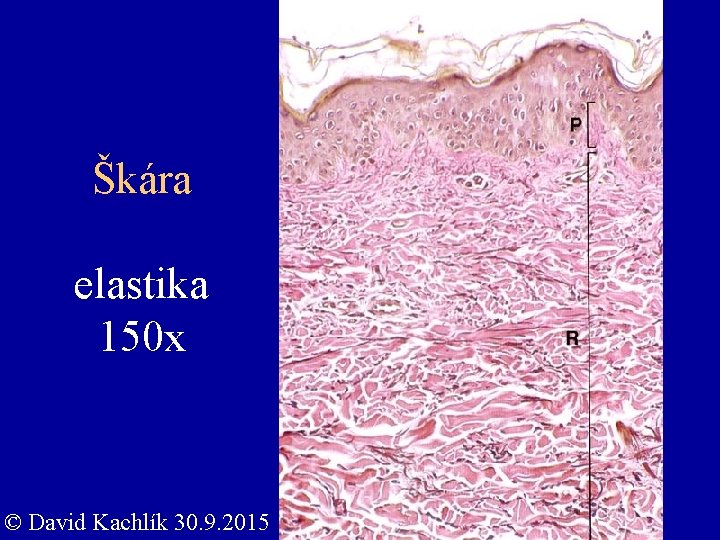Škára elastika 150 x © David Kachlík 30. 9. 2015 