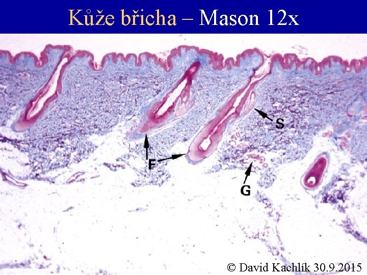 Kůže břicha – Mason 12 x © David Kachlík 30. 9. 2015 