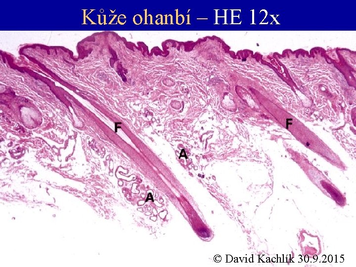Kůže ohanbí – HE 12 x © David Kachlík 30. 9. 2015 