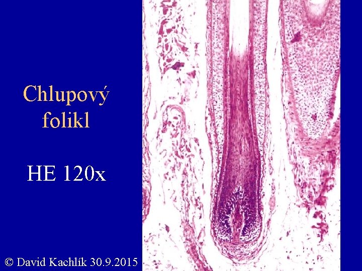 Chlupový folikl HE 120 x © David Kachlík 30. 9. 2015 