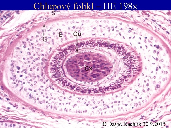 Chlupový folikl – HE 198 x • dřeň (medulla) • kůra (cortex) • cuticula
