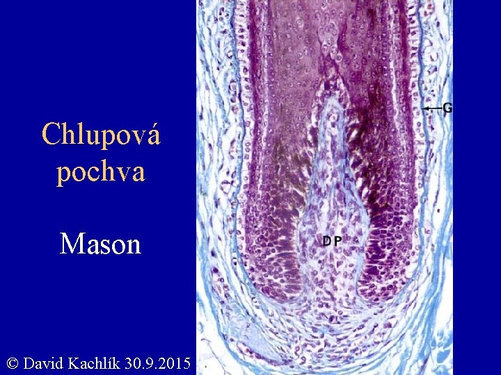 Chlupová pochva Mason © David Kachlík 30. 9. 2015 