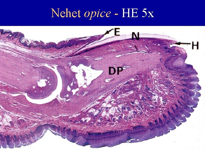 Nehet opice - HE 5 x 
