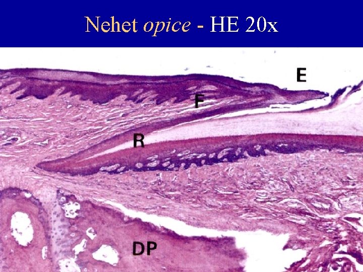 Nehet opice - HE 20 x 