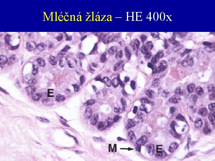 Mléčná žláza – HE 400 x 
