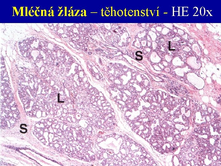 Mléčná žláza – těhotenství - HE 20 x 