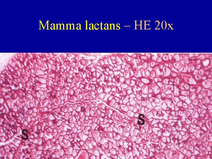 Mamma lactans – HE 20 x 
