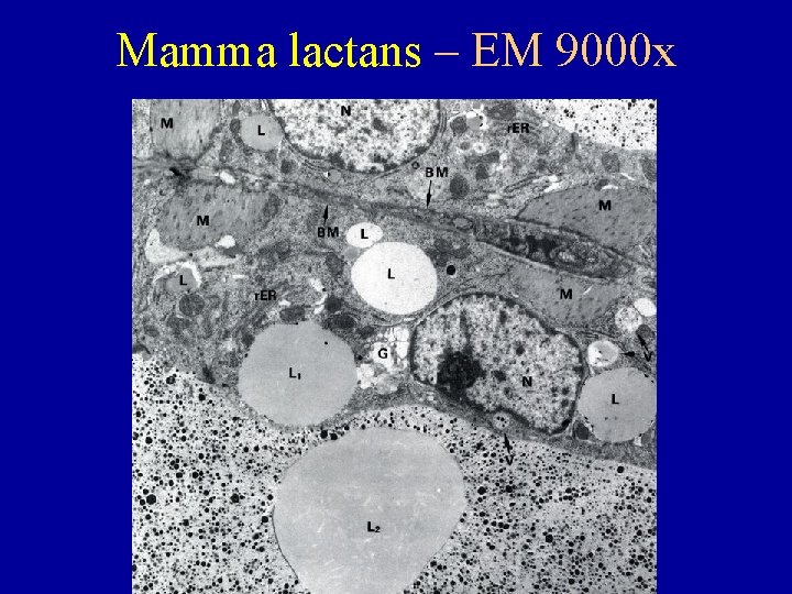 Mamma lactans – EM 9000 x 