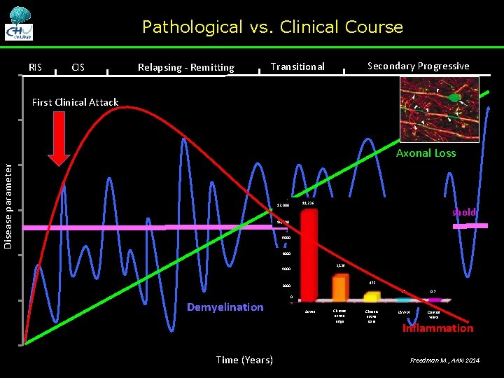 Pathological vs. Clinical Course RIS CIS Relapsing - Remitting Secondary Progressive Transitional First Clinical Pathological vs. Clinical Course RIS CIS Relapsing - Remitting Secondary Progressive Transitional First Clinical