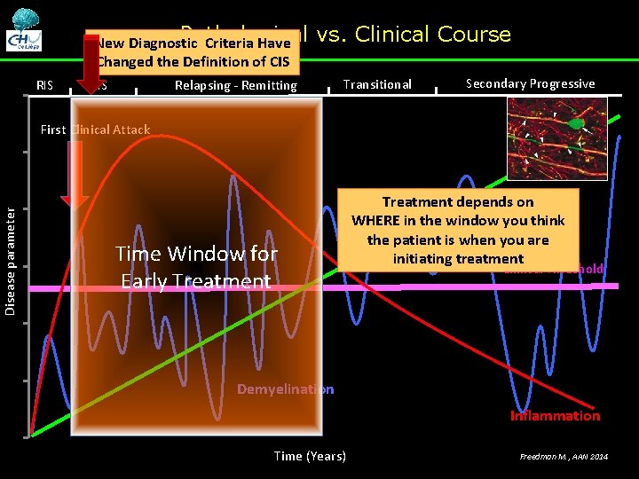 Pathological New Diagnostic Criteria Have Changed the Definition of CIS RIS vs. Clinical Course Pathological New Diagnostic Criteria Have Changed the Definition of CIS RIS vs. Clinical Course