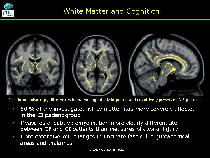 White Matter and Cognition Fractional anisotropy differences between cognitively impaired and cognitively preserved MS White Matter and Cognition Fractional anisotropy differences between cognitively impaired and cognitively preserved MS