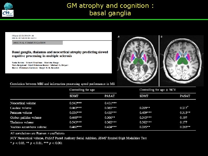 GM atrophy and cognition : basal ganglia GM atrophy and cognition : basal ganglia