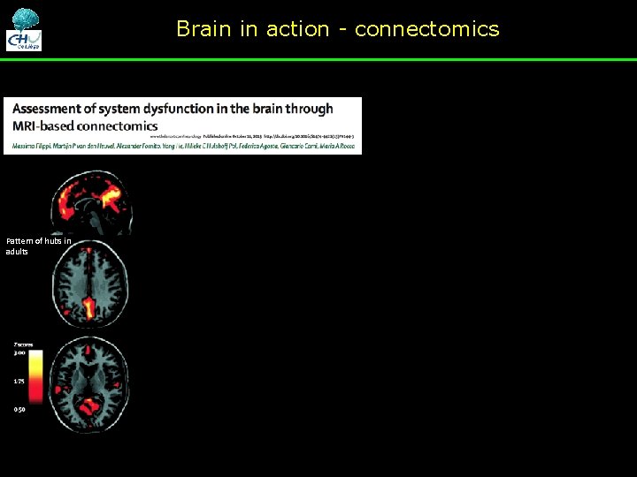 Brain in action - connectomics Pattern of hubs in adults Brain in action - connectomics Pattern of hubs in adults