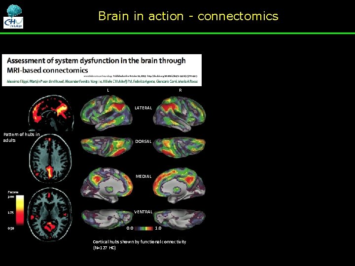 Brain in action - connectomics L R LATERAL Pattern of hubs in adults DORSAL Brain in action - connectomics L R LATERAL Pattern of hubs in adults DORSAL