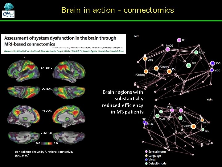 Brain in action - connectomics L R LATERAL DORSAL Brain regions with substantially reduced Brain in action - connectomics L R LATERAL DORSAL Brain regions with substantially reduced