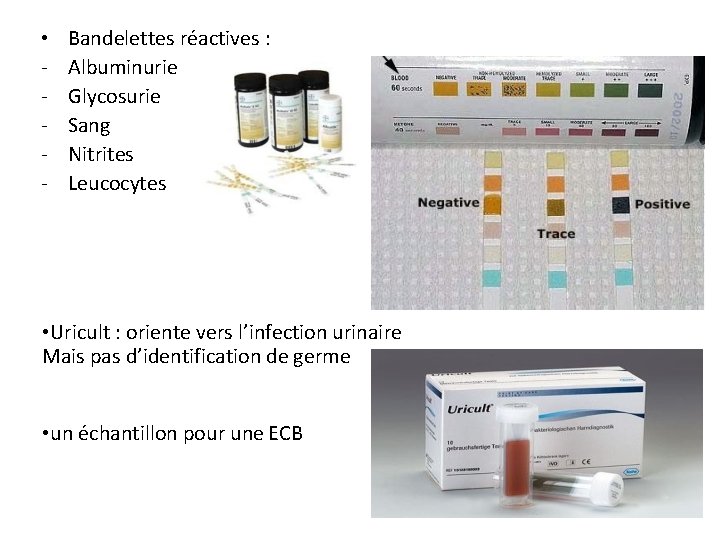  • - Bandelettes réactives : Albuminurie Glycosurie Sang Nitrites Leucocytes • Uricult :