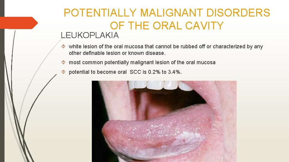POTENTIALLY MALIGNANT DISORDERS OF THE ORAL CAVITY LEUKOPLAKIA white lesion of the oral mucosa