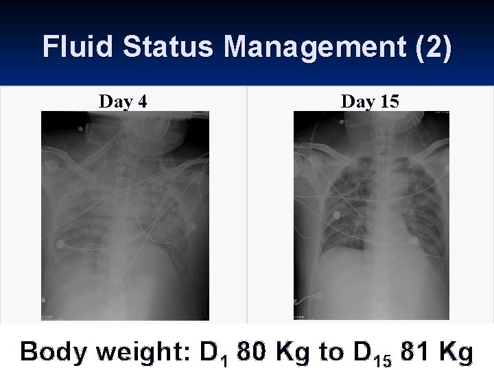 Fluid Status Management (2) Day 4 Day 15 Body weight: D 1 80 Kg