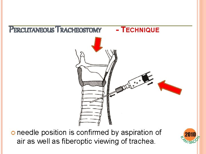 PERCUTANEOUS TRACHEOSTOMY needle - TECHNIQUE position is confirmed by aspiration of air as well