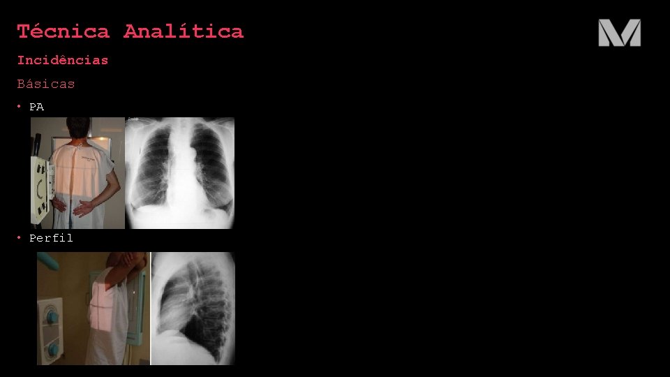 Técnica Analítica Incidências Básicas • PA • Perfil 