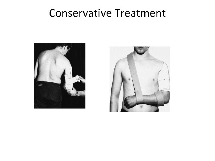 Conservative Treatment 