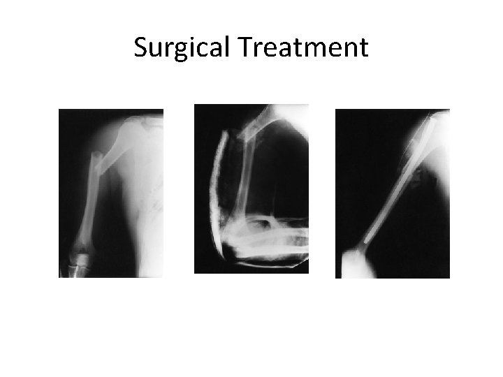 Surgical Treatment 