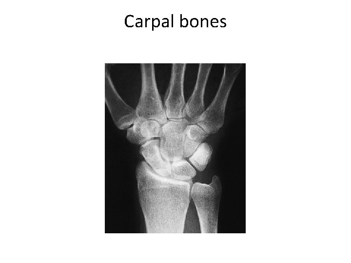 Carpal bones 