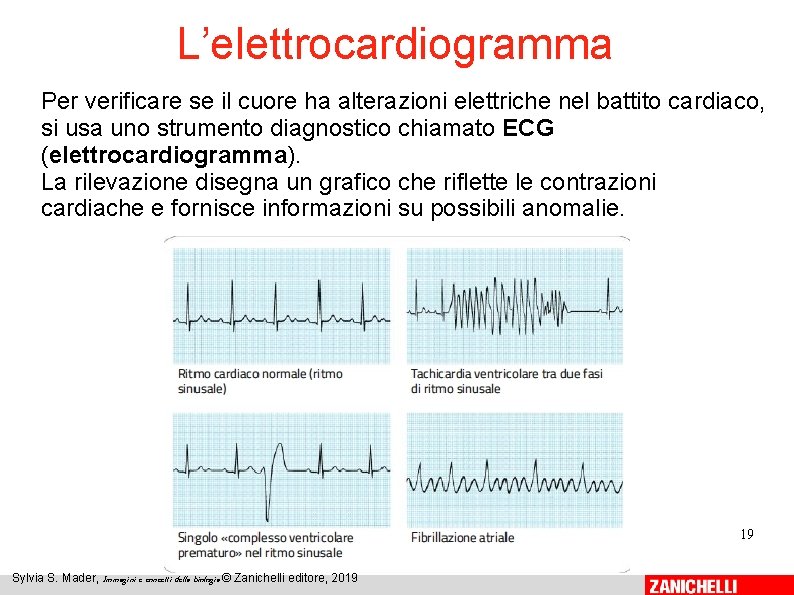 L’elettrocardiogramma Per verificare se il cuore ha alterazioni elettriche nel battito cardiaco, si usa