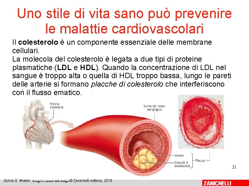 Uno stile di vita sano può prevenire le malattie cardiovascolari Il colesterolo è un