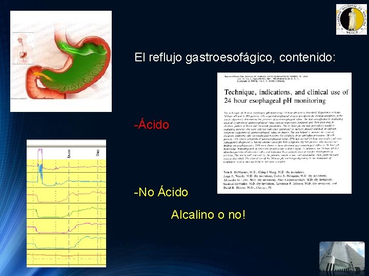 El reflujo gastroesofágico, contenido: -Ácido -No Ácido Alcalino o no! El reflujo gastroesofágico, contenido: -Ácido -No Ácido Alcalino o no!