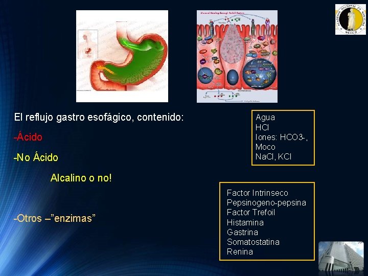 El reflujo gastro esofágico, contenido: -Ácido -No Ácido Agua HCl Iones: HCO 3 -, El reflujo gastro esofágico, contenido: -Ácido -No Ácido Agua HCl Iones: HCO 3 -,