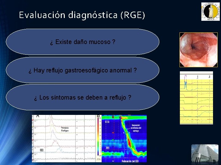 Evaluación diagnóstica (RGE) ¿ Existe daño mucoso ? ¿ Hay reflujo gastroesofágico anormal ? Evaluación diagnóstica (RGE) ¿ Existe daño mucoso ? ¿ Hay reflujo gastroesofágico anormal ?