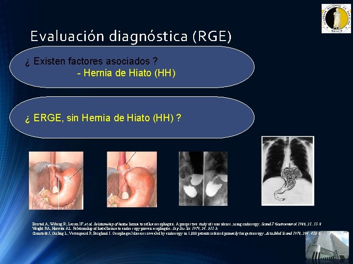 Evaluación diagnóstica (RGE) ¿ Existen factores asociados ? - Hernia de Hiato (HH) ¿ Evaluación diagnóstica (RGE) ¿ Existen factores asociados ? - Hernia de Hiato (HH) ¿